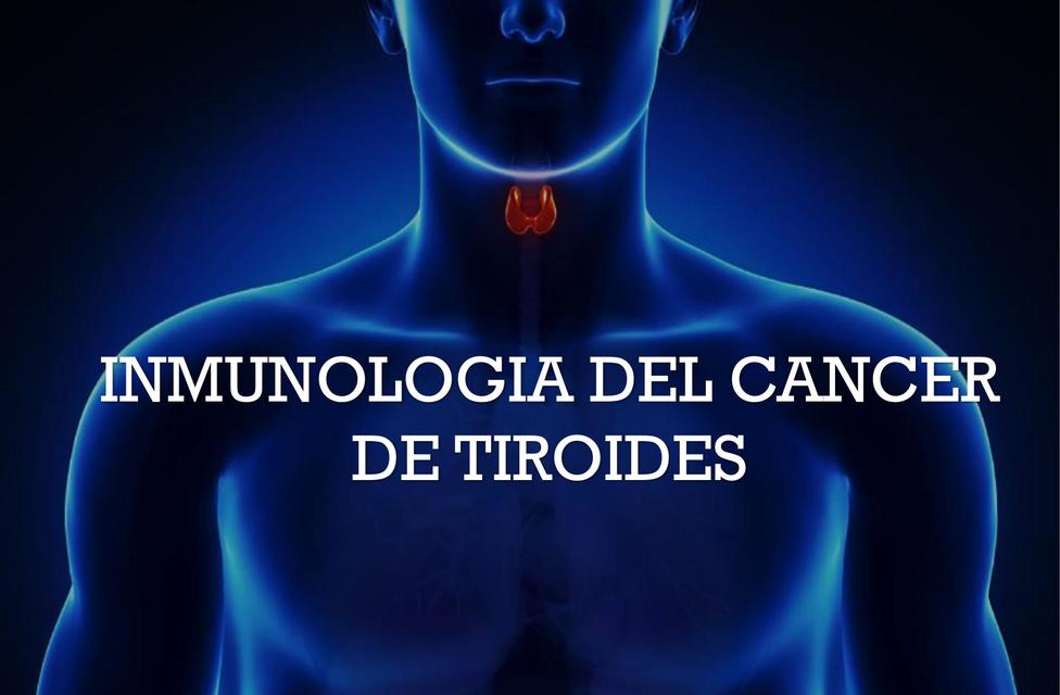 Inmunología de Cáncer de Tiroides