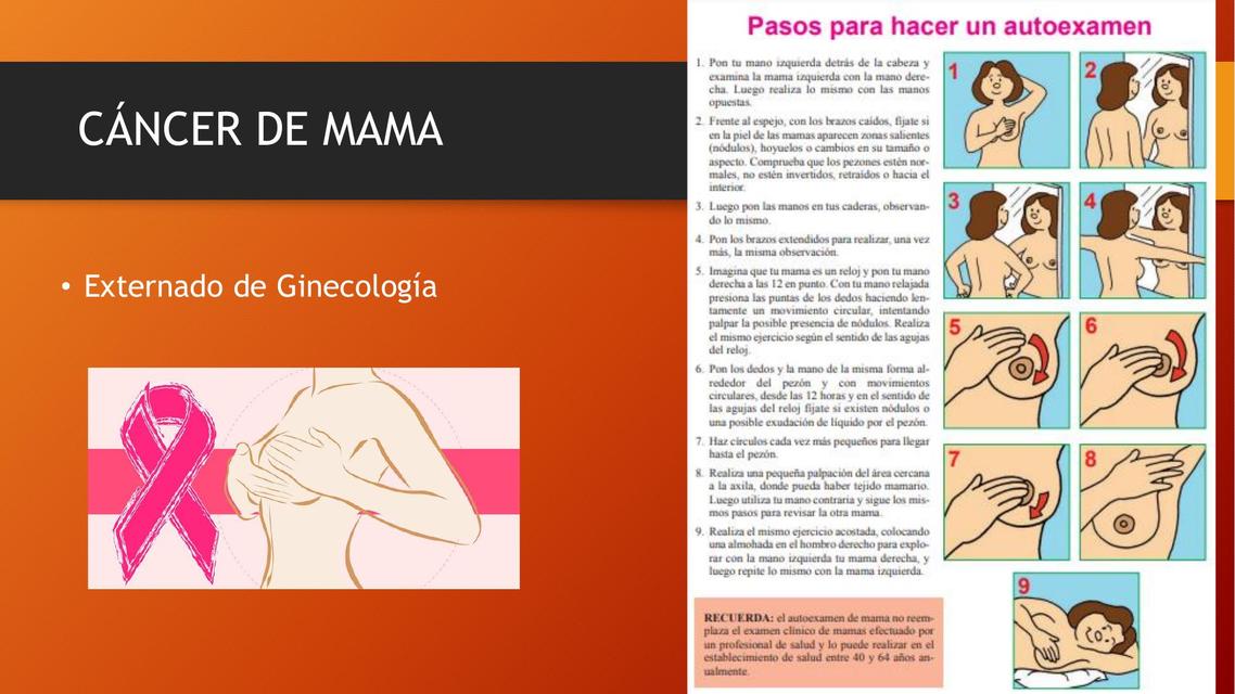 Cáncer de mama