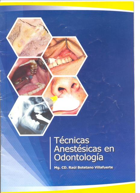 Técnicas Anestésicas En Odontología 