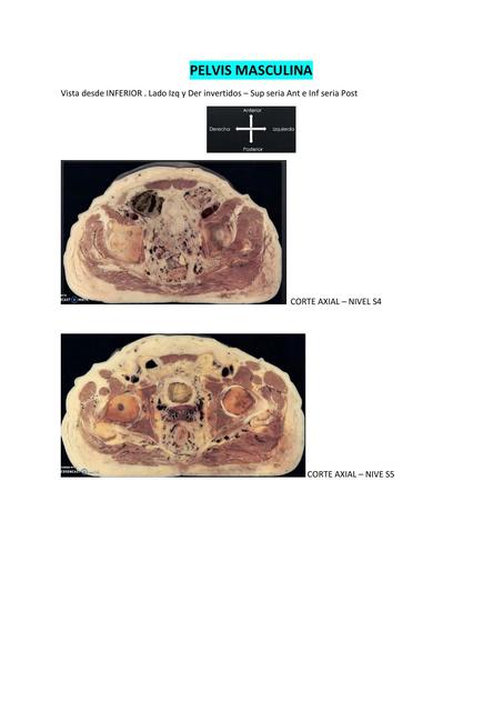 Cortes de Pelvis 