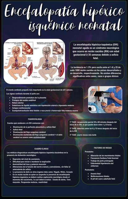 Encefalopatía Hipóxico Isquémico Neonatal