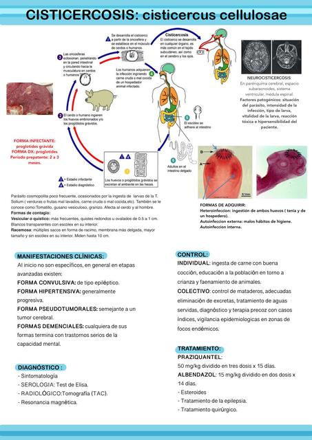 Cisticercosis