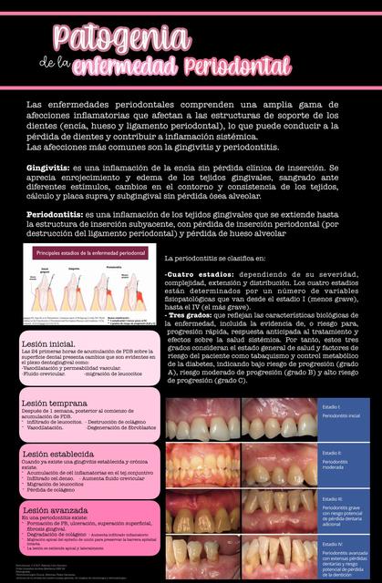 Patogenia de la Enfermedad Periodontal