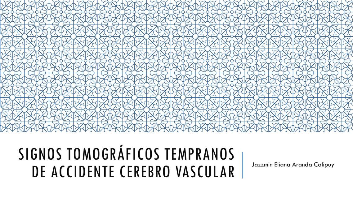 Signos Tomográficos Tempranos de Accidente Cerebro Vascular