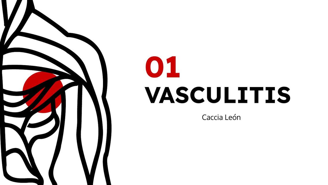 Vasculitis 