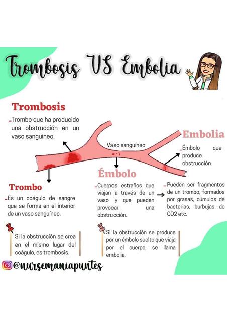 Trombosis Vs Embolia Nursemaniapuntes Udocz