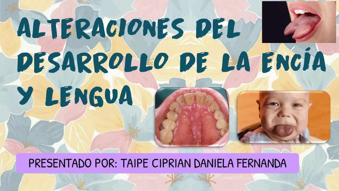 Alteración del desarrollo de la encía y lengua 