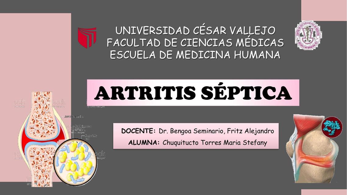 Artritis séptica Maria Stefany Chuquitucto Torres uDocz