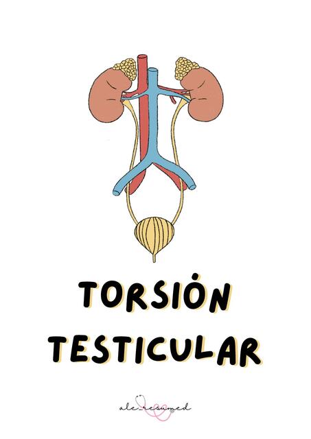 Torsión testicular 