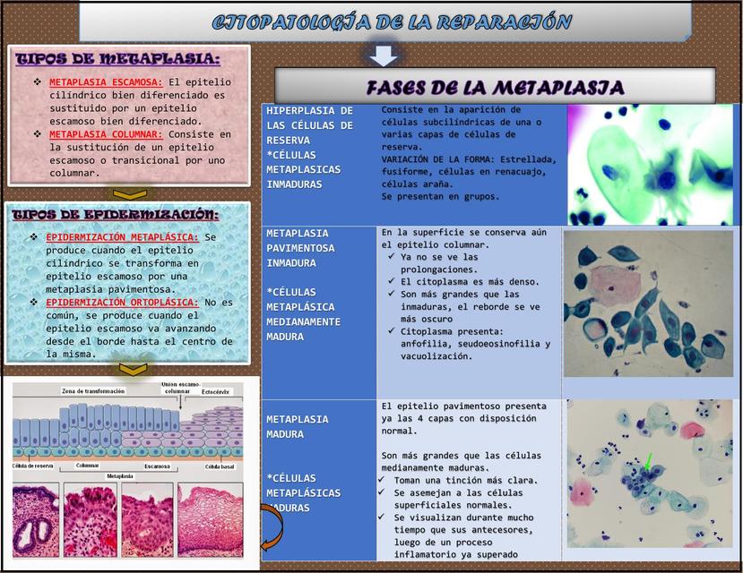 Citología Metaplasia