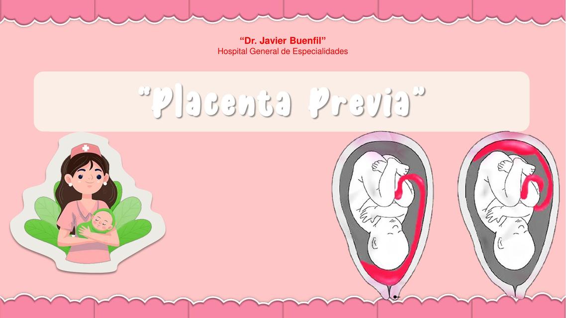 Placenta Previa