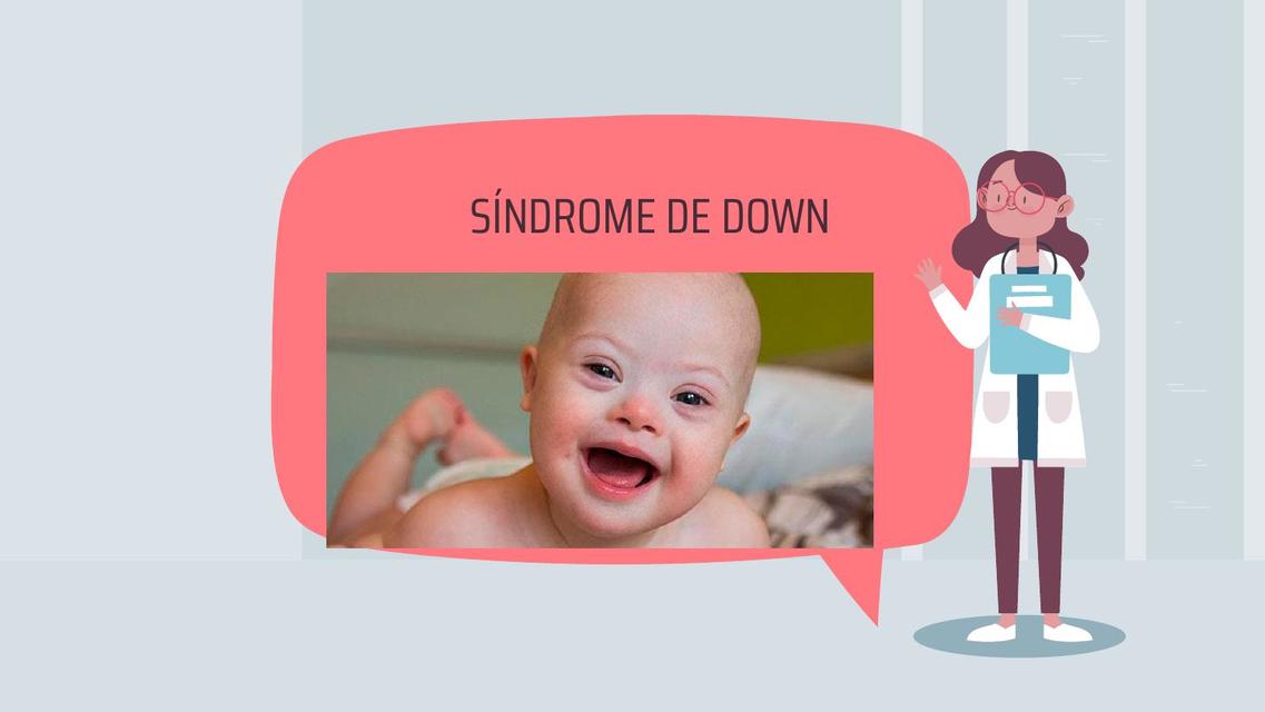 Síndrome de Down