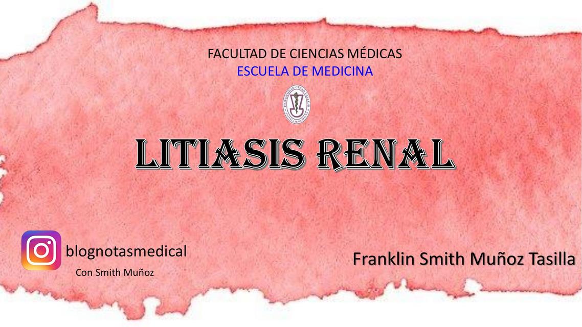 Litiasis renal