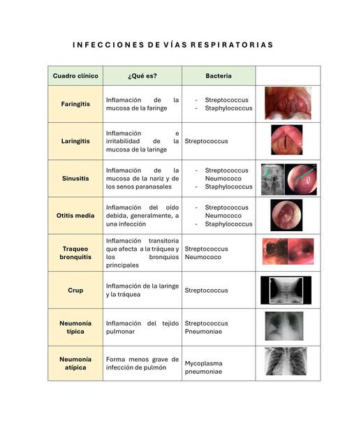 Infecciones de Vías Respiratorias