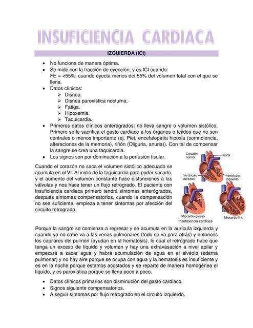 Insuficiencia Cardíaca