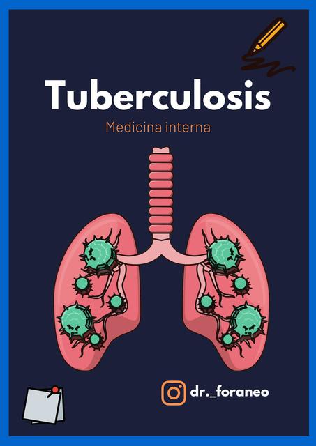 Tuberculosis pulmonar