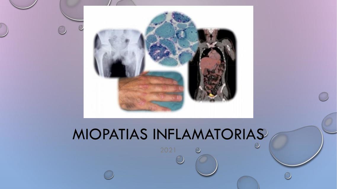 Miopatías Inflamatorias