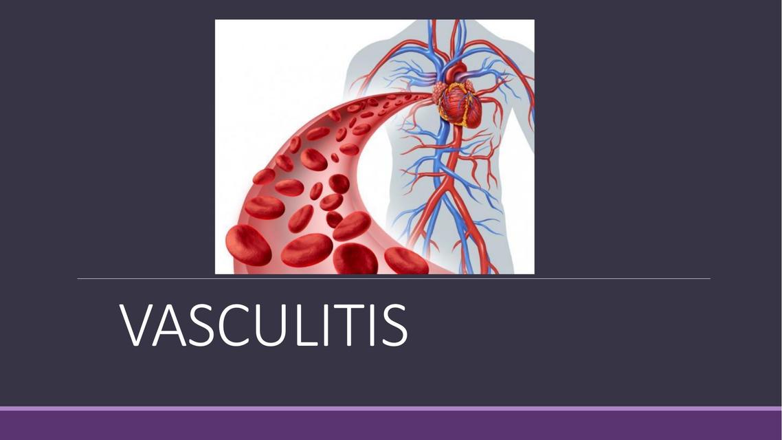 Vasculitis