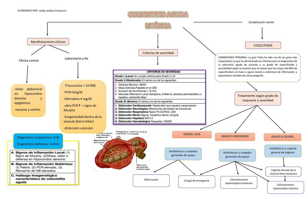 Colecistitis Aguda