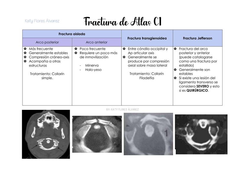 Fractura de Atlas C1 | Katy Flores | uDocz