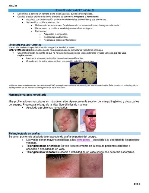 Lesiones Vasculares Tumorales