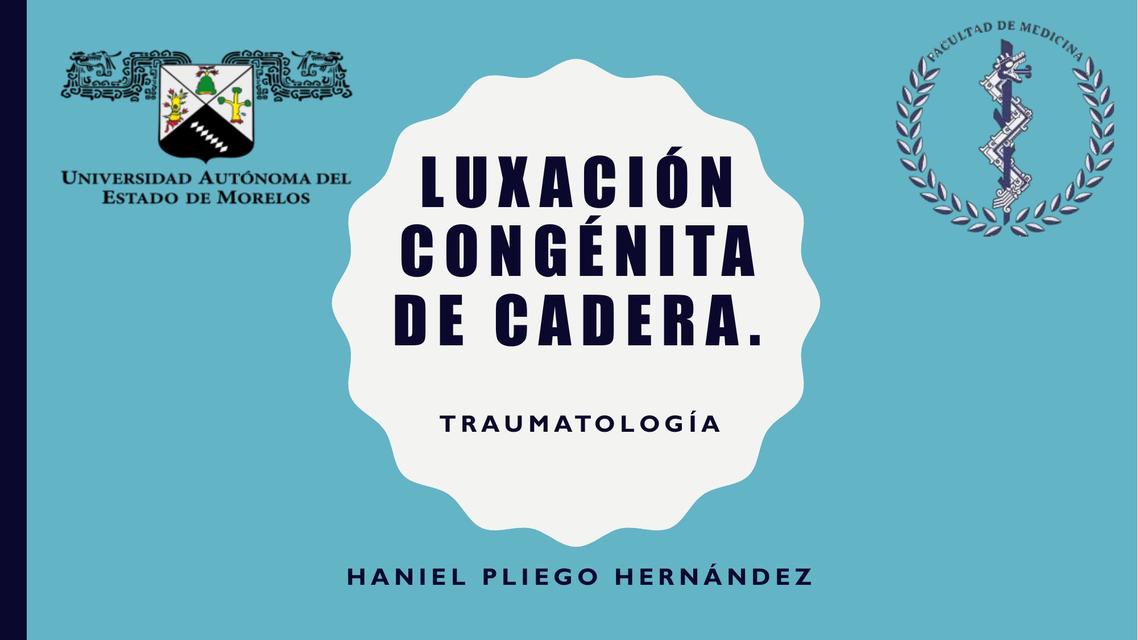 Luxación Congénita de Cadera