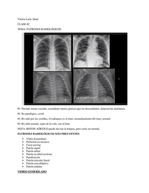Patrones Radiológicos 
