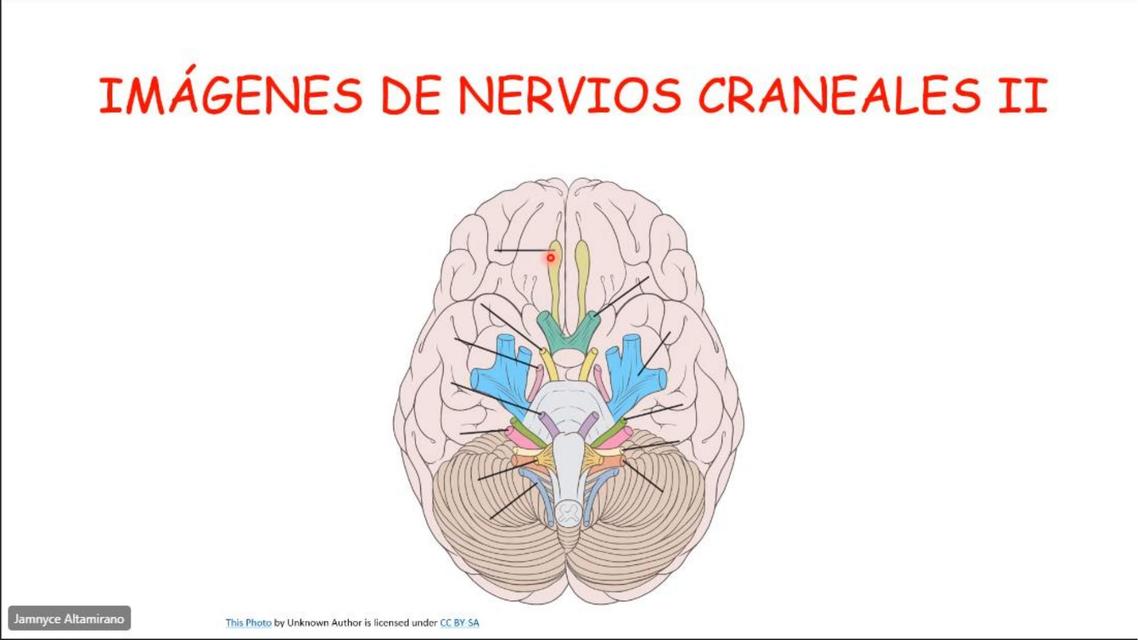 Atlas Nervios Craneales II