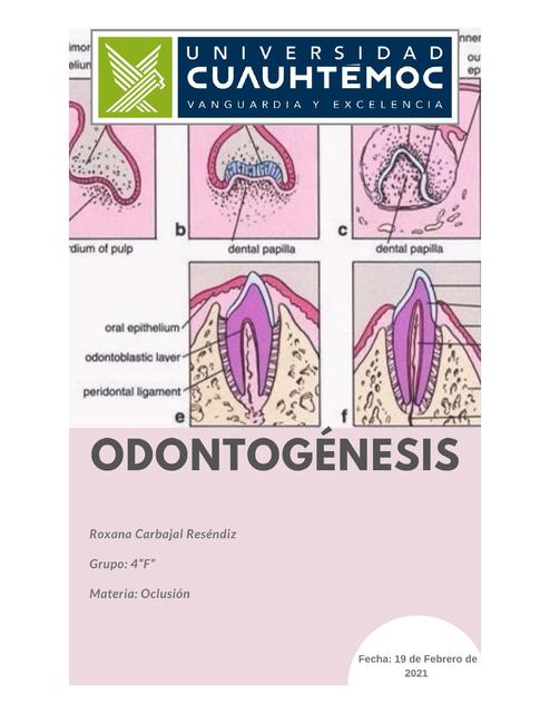 Odontogénesis