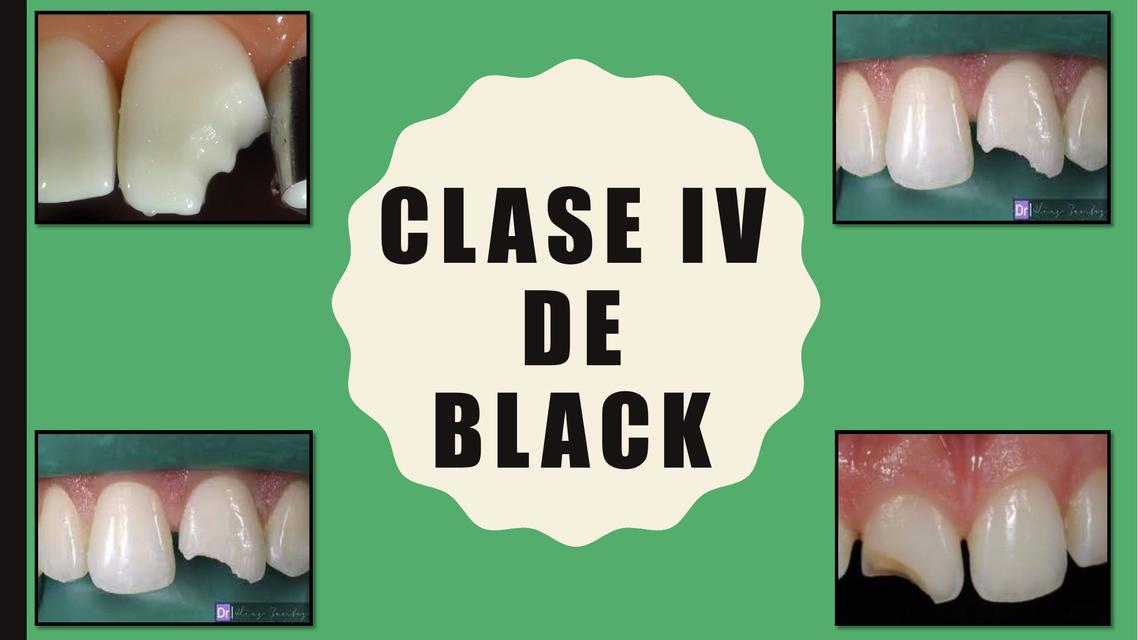 Clase de Black IV