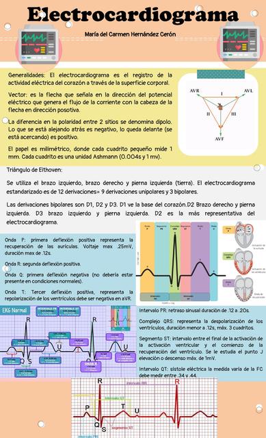 ELECTROCADIOGRAMA