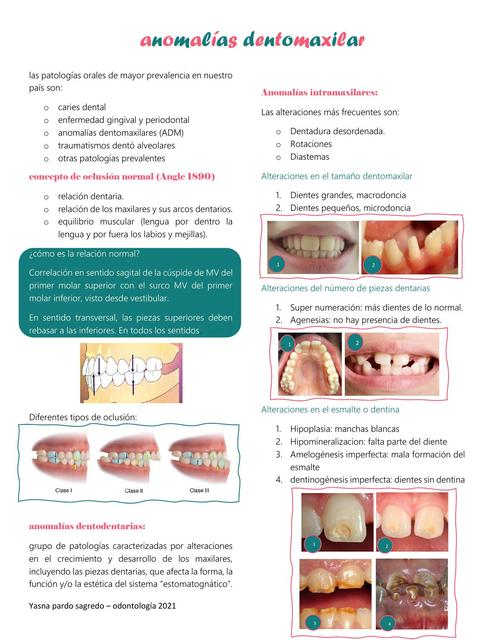 Anomalías Dentomaxilar