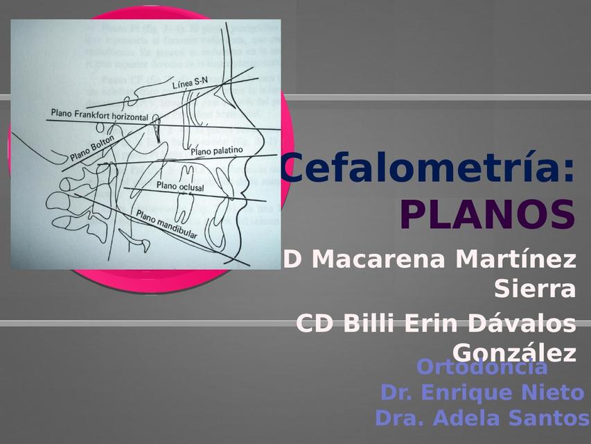 Planos Cefalométricos