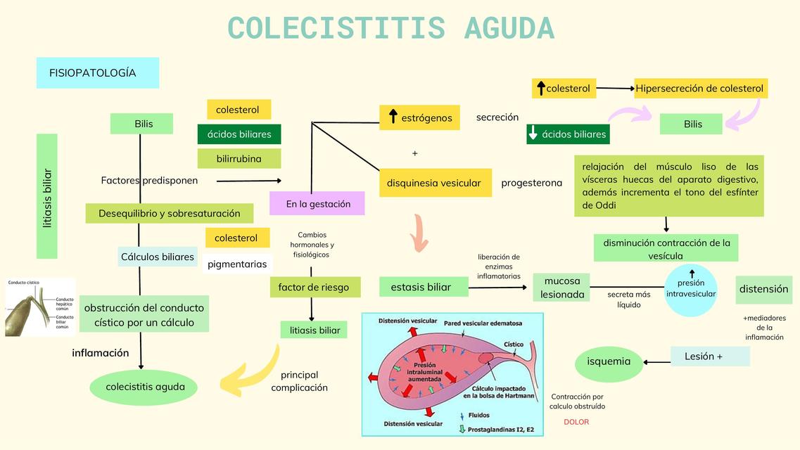 Resúmenes De Colecistitis Aguda | Descarga Apuntes De Colecistitis Aguda