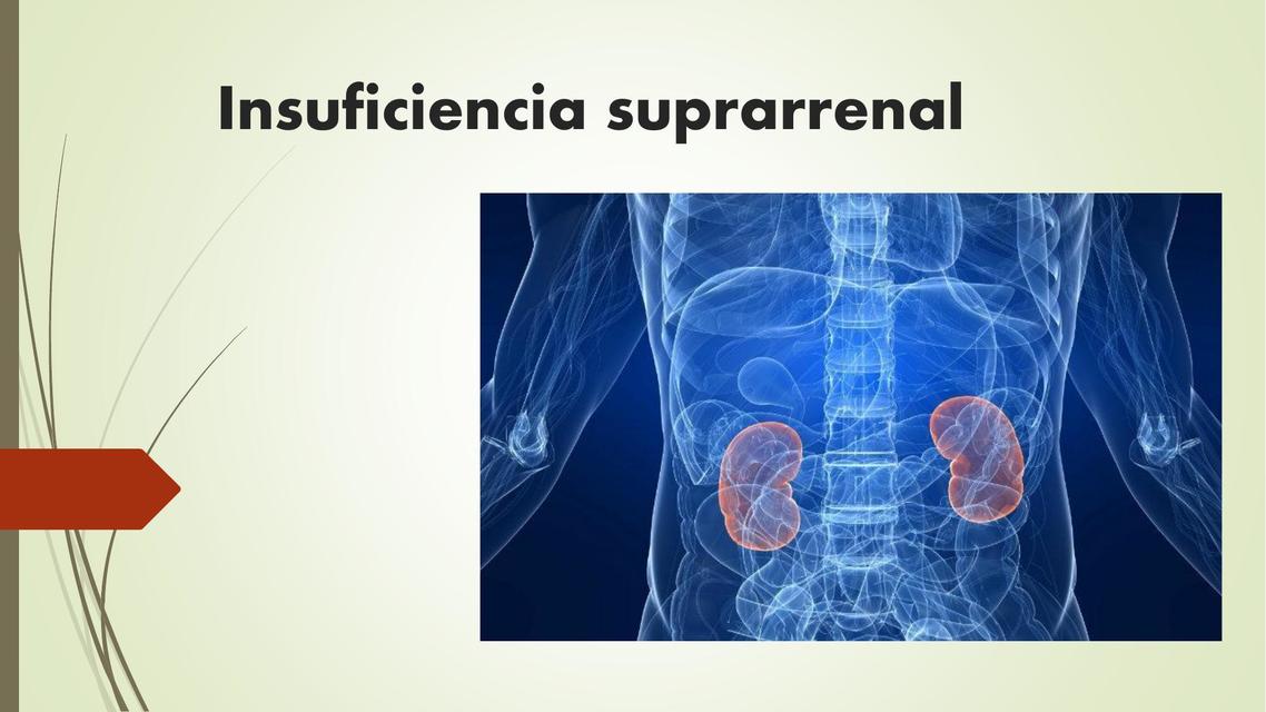 Insuficiencia Suprarrenal