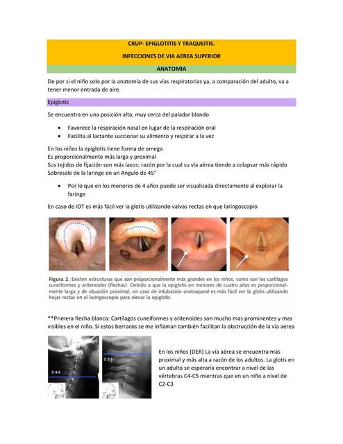 Infecciones Vía Aérea Superior