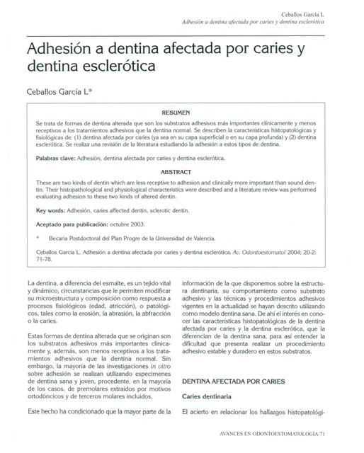 Dentina Afectada e Infectada