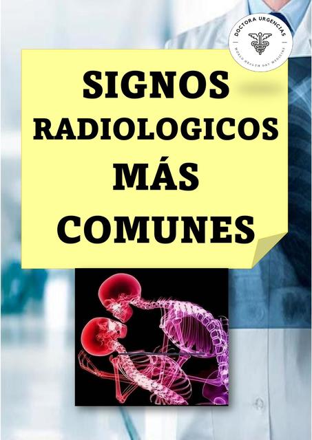 Signos Radiológicos Mas Comunes 