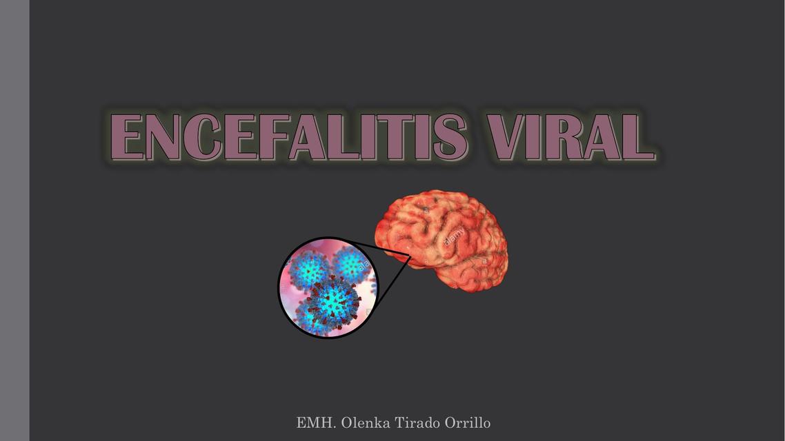 Encefalitis Viral 