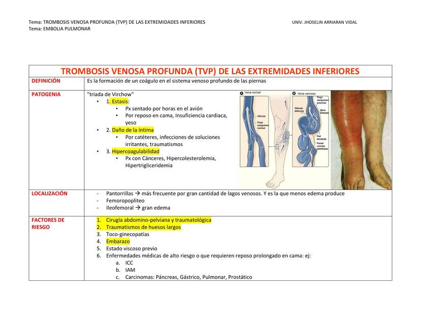 Trombosis Venosa Profunda De Las Extremidades Inferiores | Arriaran ...