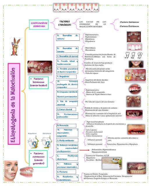 Etiopatogenia de la Maloclusión