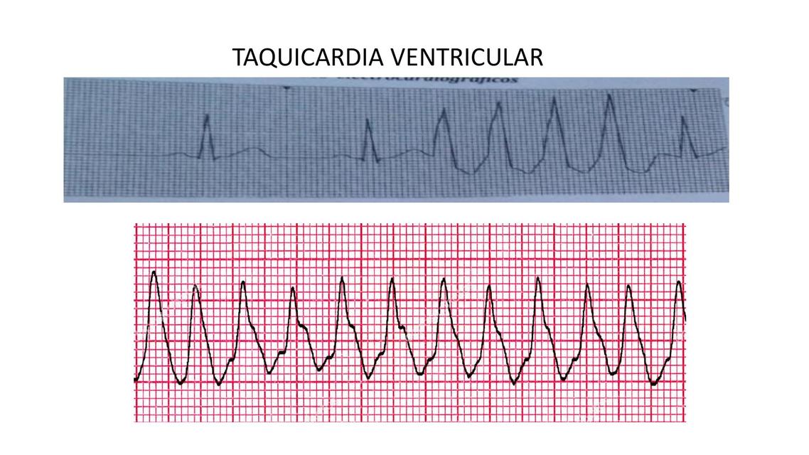 Electros para Practicar