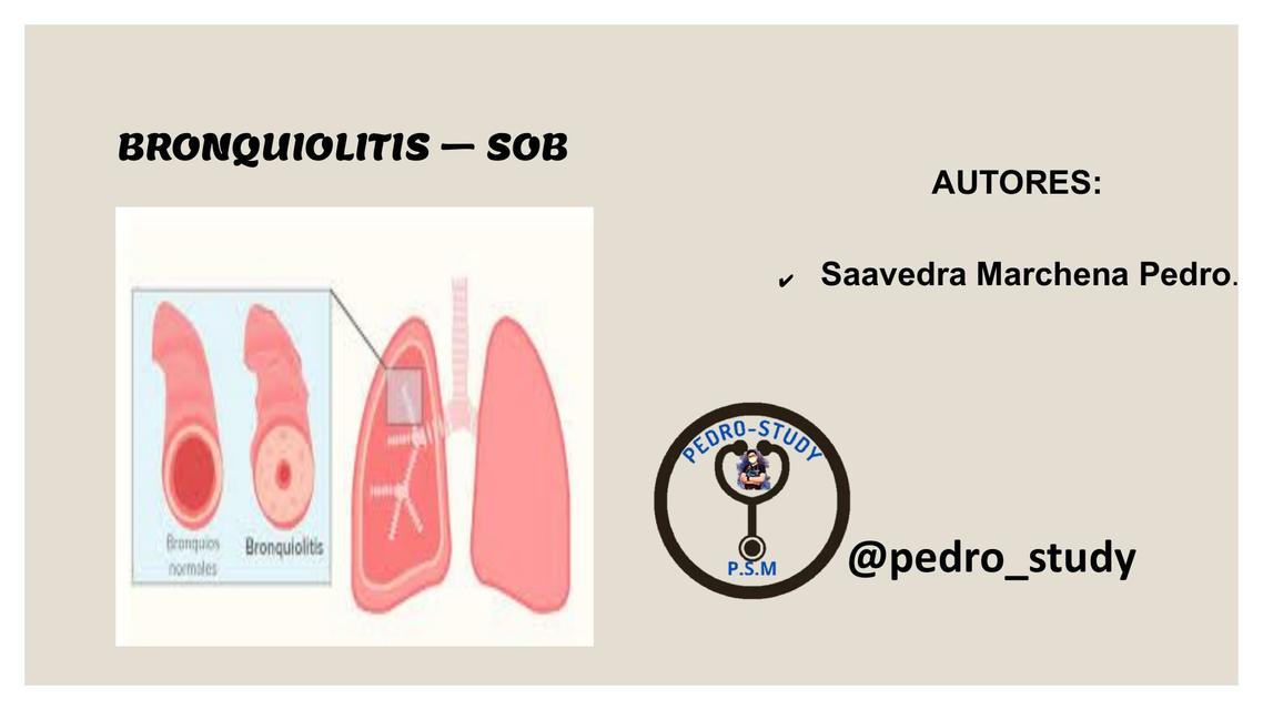 Bronquiolitis 