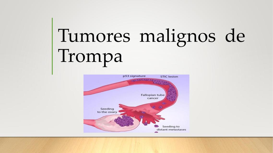 Tumores malignos de Trompa