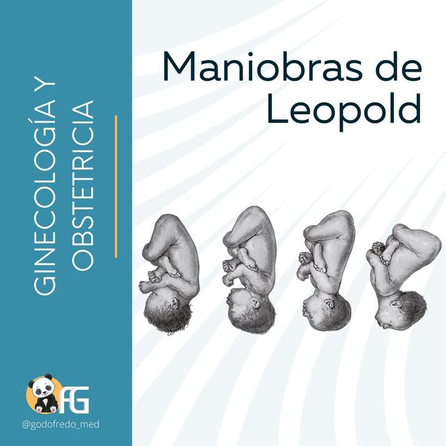 Maniobras de Leopold