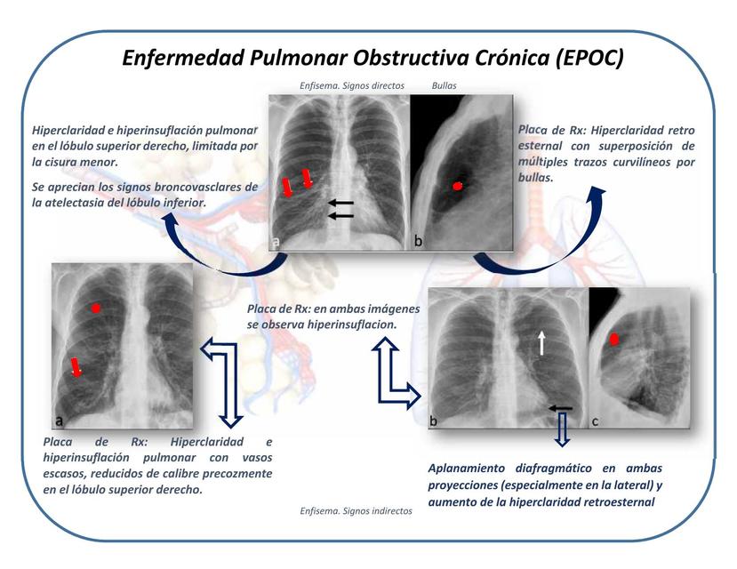 Neumología 