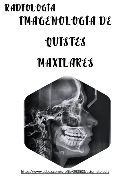 Imagenología de quistes maxilares