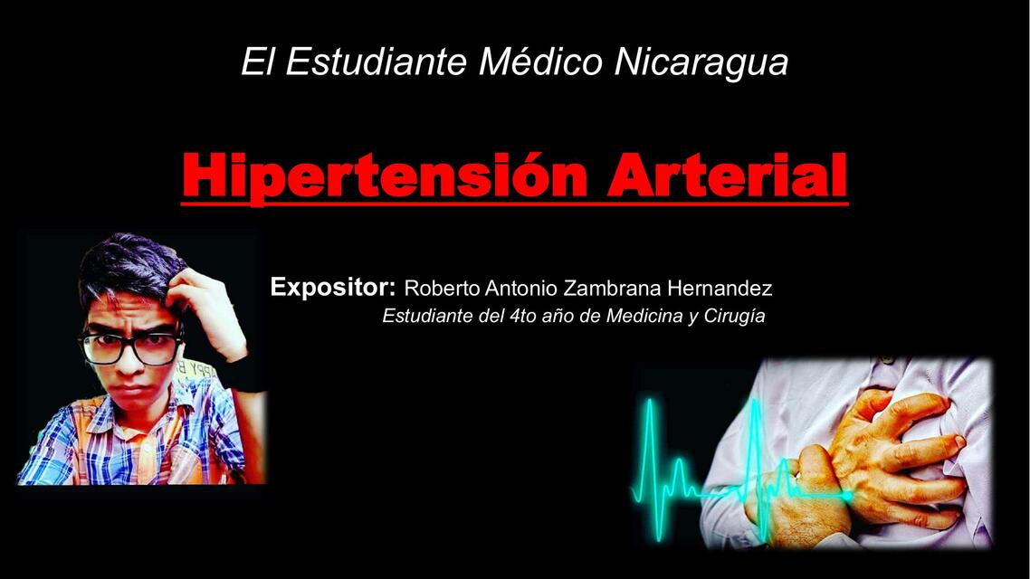 Hipertensión Arterial 