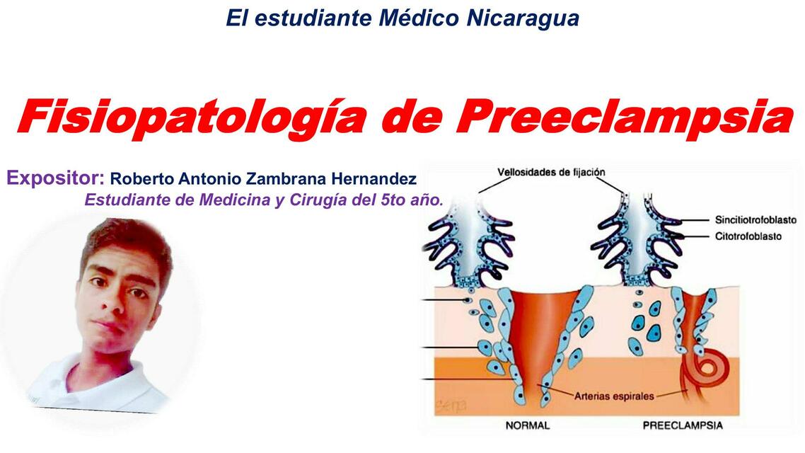 Fisiopatología de Preeclampsia