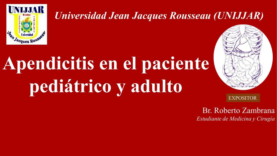 Apendicitis en el Paciente Pediátrico y Adulto  